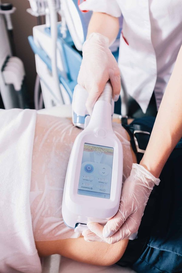 Cryolipolyse : tout ce qu'il faut savoir sur le sujet !