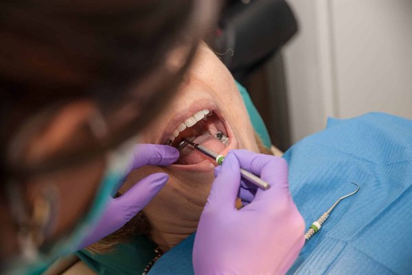 Optez pour les services de dentiste à Salon-de-Provence